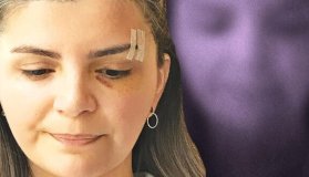 Kırılan Yüzüm Değil, Doktorluk Onurum