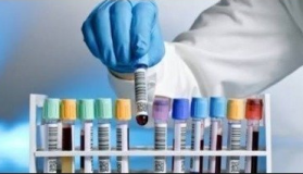 Eskişehir Halkının Laboratuvar Çilesi