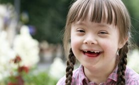 Down Sendromlular Günü